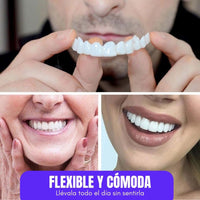 DentalGlow® Carillas de Resina para una Sonrisa Natural