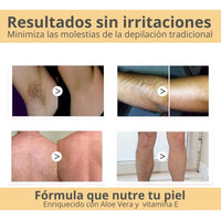 SoftSkin® Depilador Hidratante en Spray