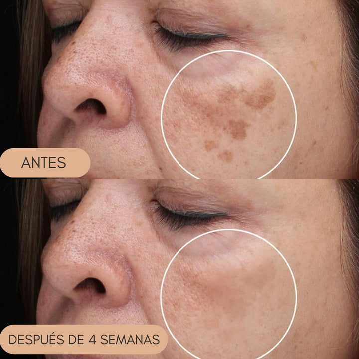 BREYLEE® Serum de Retinol Quita Manchas