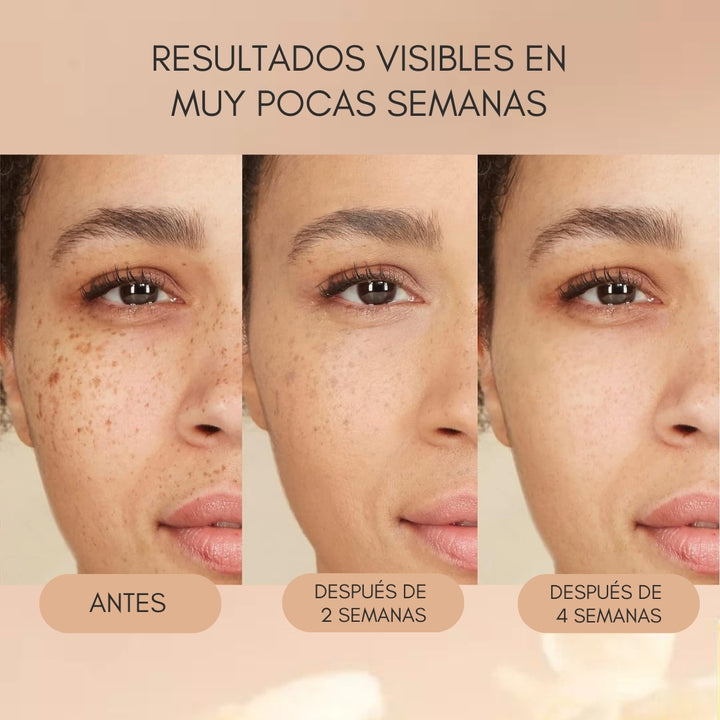 BREYLEE® Serum de Retinol Quita Manchas