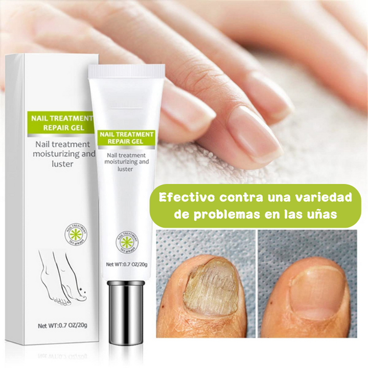 Fungi® Tratamiento Revitalizante De Uñas